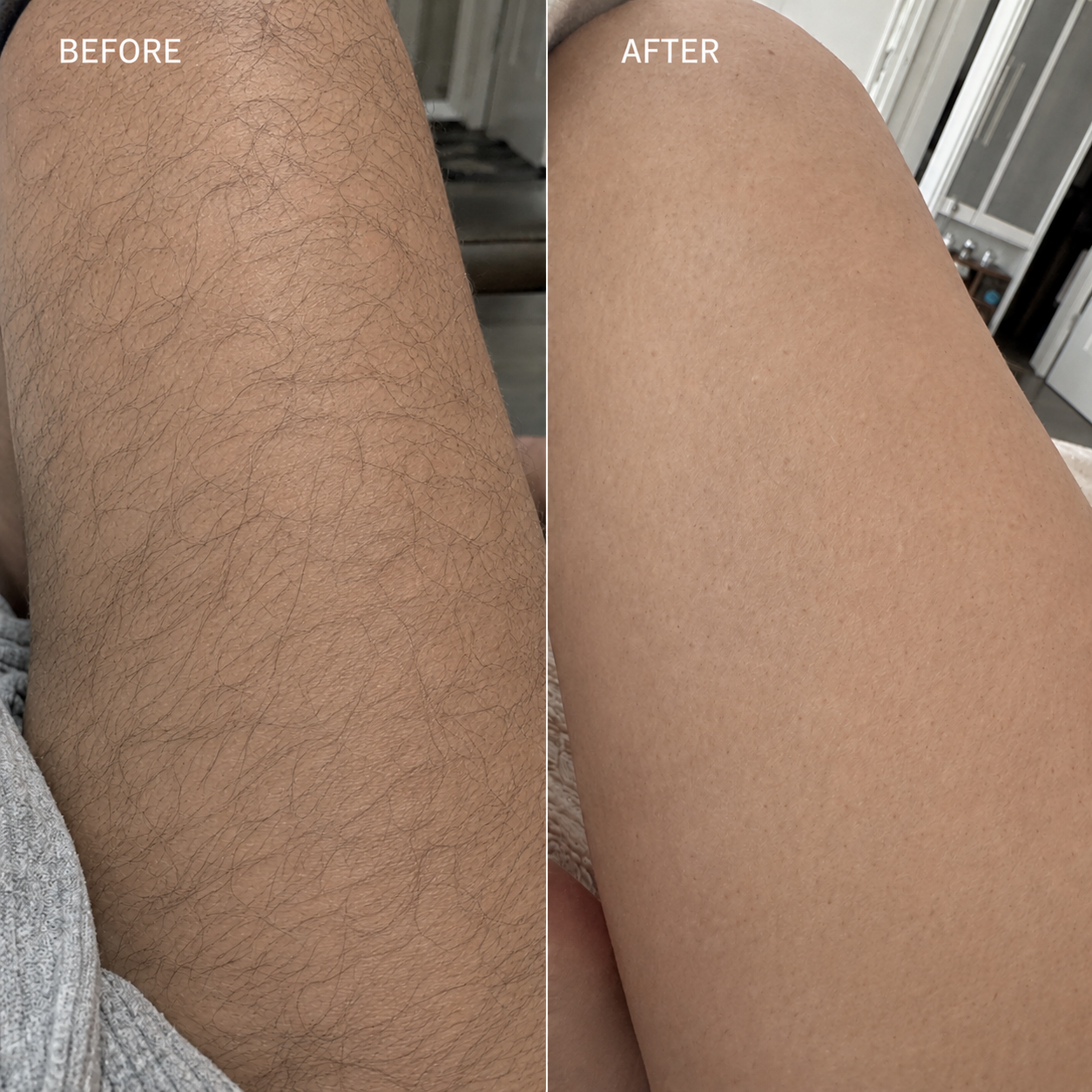 Snatched Hair Removal Cream