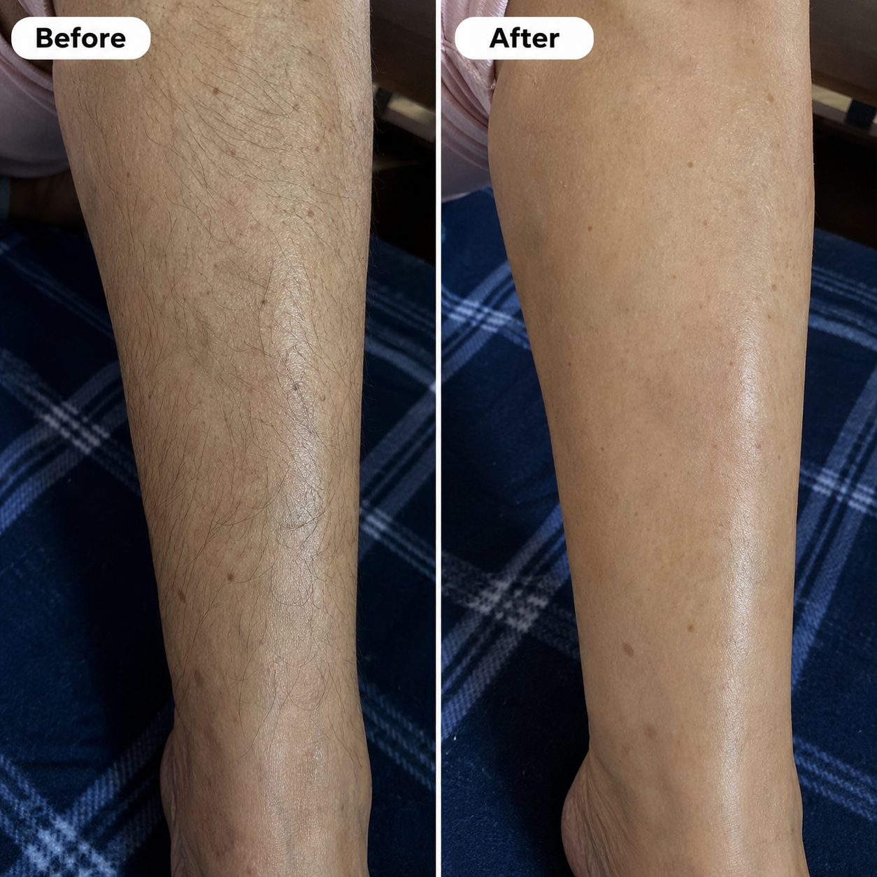 Snatched Hair Removal Cream